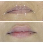 Top Skin Specialist in Ahmedabad