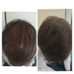 Top Skin Specialist in Ahmedabad