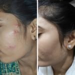 Top Skin Specialist in Ahmedabad