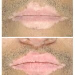 Top Skin Specialist in Ahmedabad