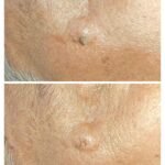 Top Skin Specialist in Ahmedabad