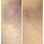 Top Skin Specialist in Ahmedabad